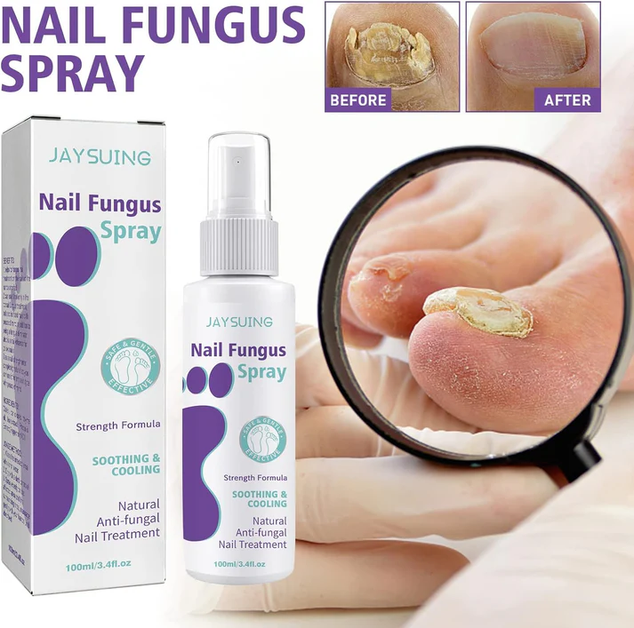 Medinail Fungus Spray - Toenail Fungus Treatment